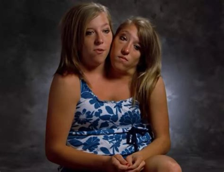 Abby and Brittany Hensel: The Remarkable Story of Conjoined Twins Living Life to the Fullest