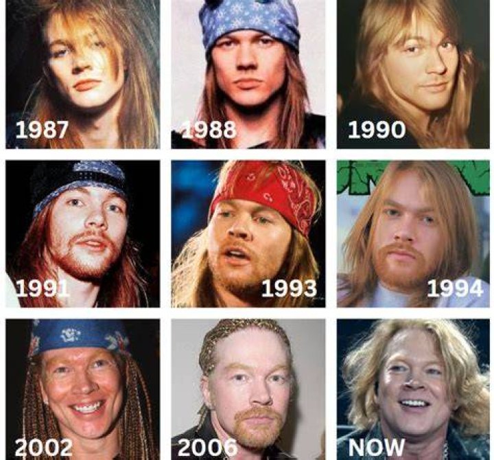 Axl Rose: The Evolution of a Rock Legend and What He Looks Like Now