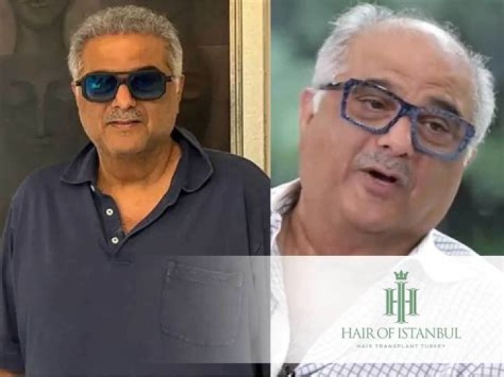 Boney Kapoor Hair: A Comprehensive Guide to Style, Care, and Expert Tips