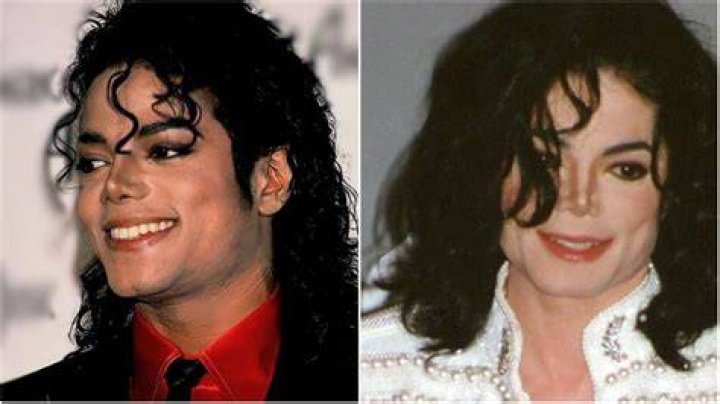 Did Michael Jackson Bleach His Skin? Unveiling the Truth Behind His Skin Color Transformation