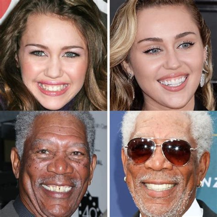 Gap Teeth & Confidence: [Celebrities Embracing Their Smiles]