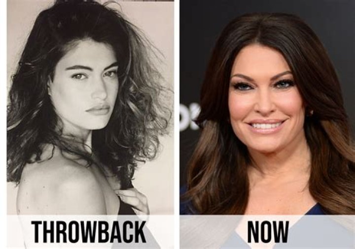 Kimberly Guilfoyle Pre-Surgery: A Comprehensive Guide
