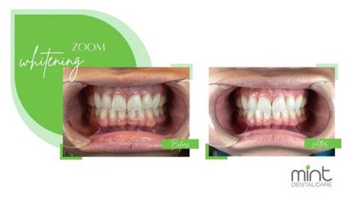 Mint Dental Works Houston: Your Premier Destination for Exceptional Dental Care