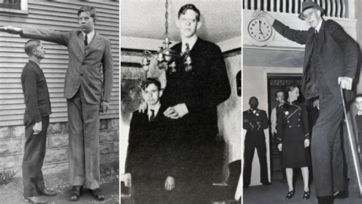 Robert Wadlow Condition: Understanding the Life and Legacy of the Tallest Man in History
