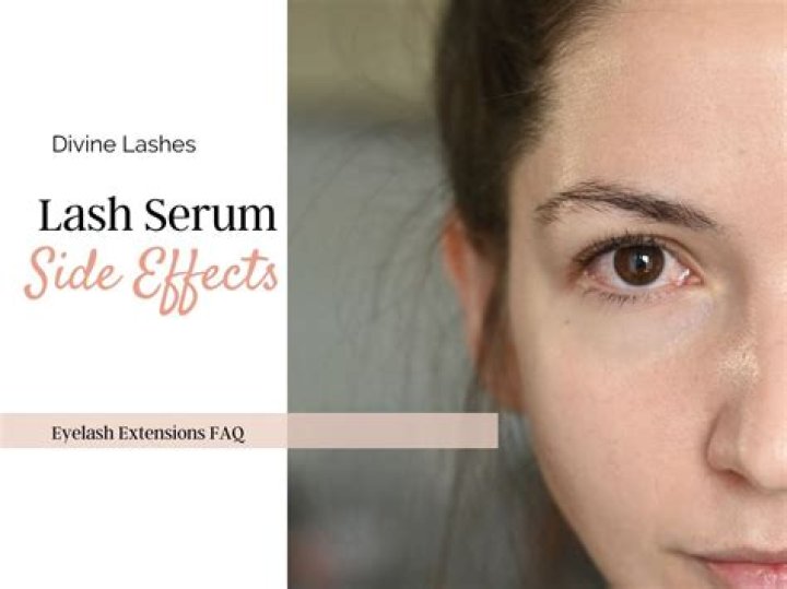 Side Effects of Grande Lash: A Comprehensive Guide to Understanding and Managing Potential Risks