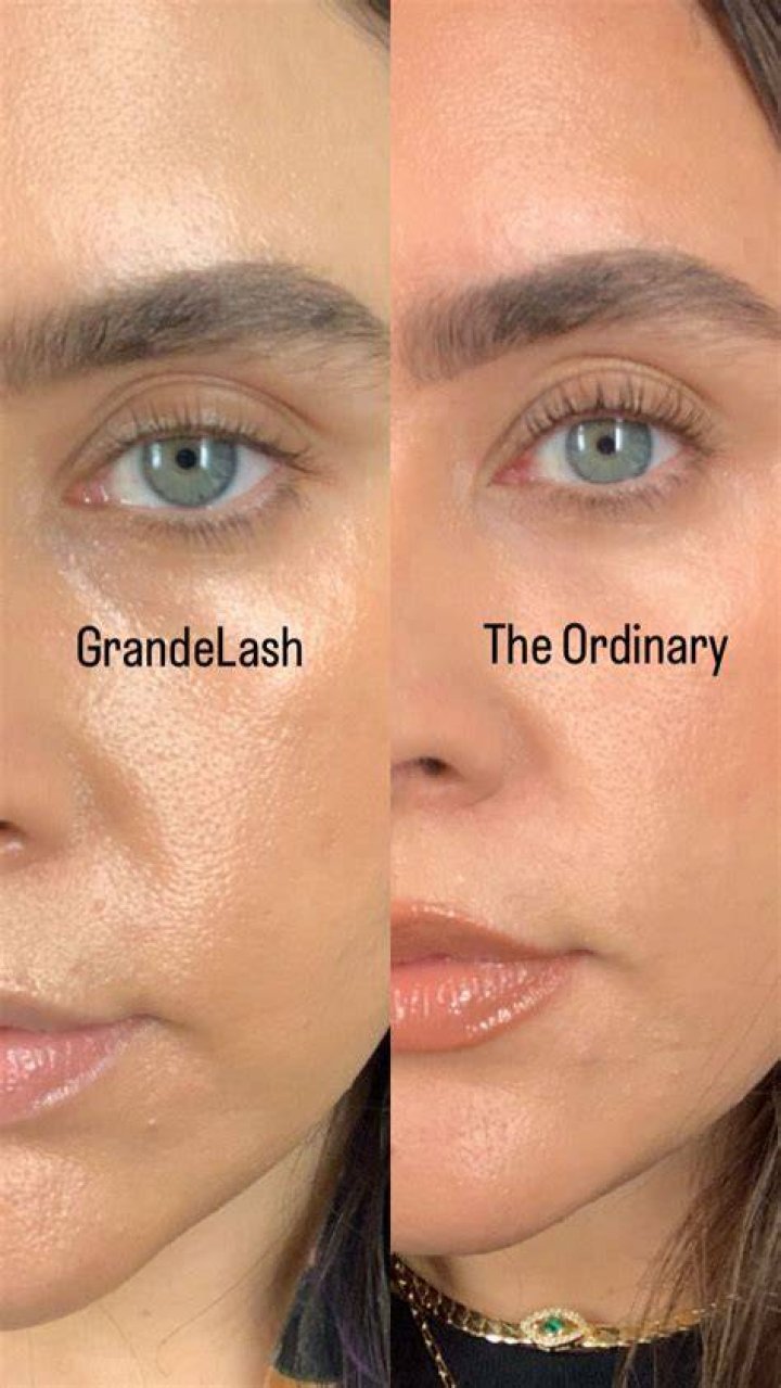 Side Effects of GrandeLash Results: What You Need to Know