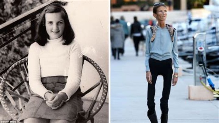 The Thinnest Person on Earth: An In-Depth Look Into Their Life, Challenges, and Journey