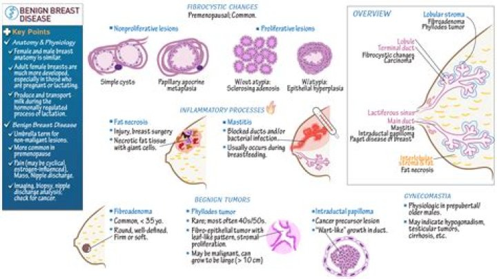 Understanding Three Breasts Condition: A Comprehensive Guide