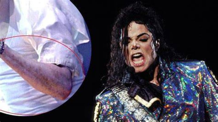 Unveiling the Truth About Michael Jackson's Vitiligo: A Comprehensive Guide