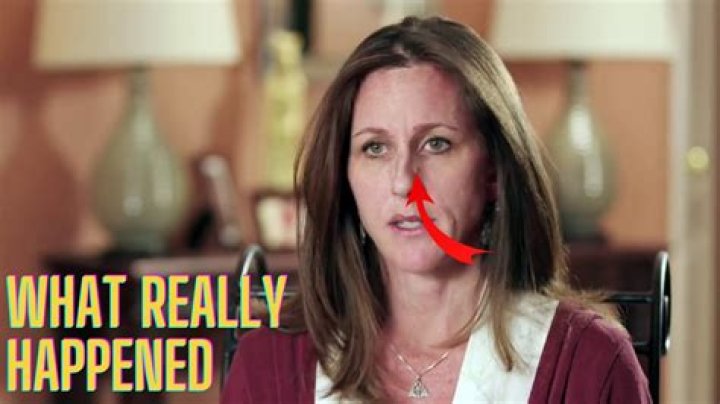 What Happened to Kim Goldman's Face: A Comprehensive Exploration